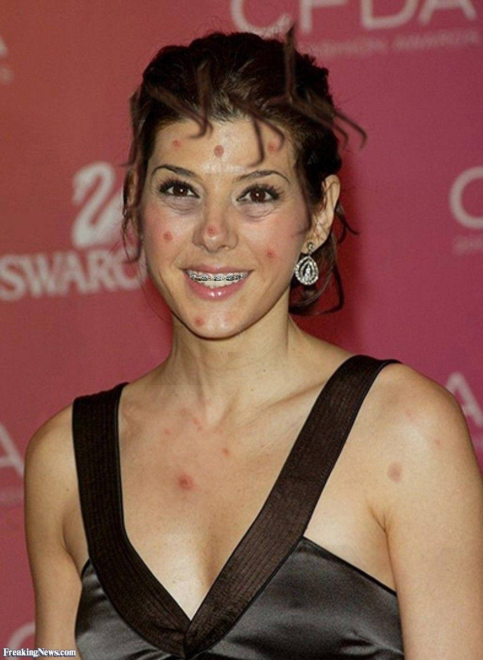 Marisa Tomei Dental Braces Wallpaper