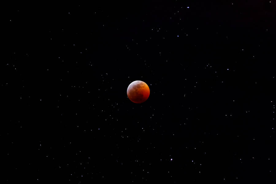 A Magnified View Of Human Blood Cells Wallpaper