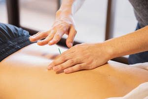 Acupuncturist Inserting Needle Through Back Skin Wallpaper