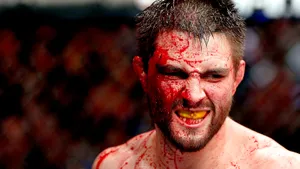 Bloody Professional Mixed Martial Artist Carlos Condit Wallpaper