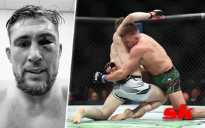 Darren Till And Fight Wounds Wallpaper