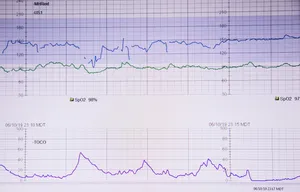 Fetal Heartbeat Monitor Wallpaper