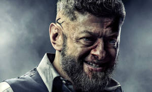 Injured Andy Serkis Wallpaper