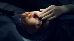 Professional Surgeon Performing Nasal Surgery Wallpaper